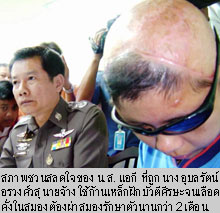 รวบนายจ้างสาวทุบกะโหลกลูกจ้างกะเหรี่ยง
